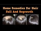 Home Remedies For Hair Fall And Regrowth, Hair Regrowth, Hair Regrowth Supplements